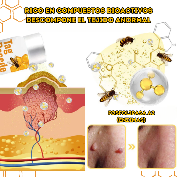 BeePure™ - Tratamiento de 7 Días para la Eliminacion de Verrugas 🐝