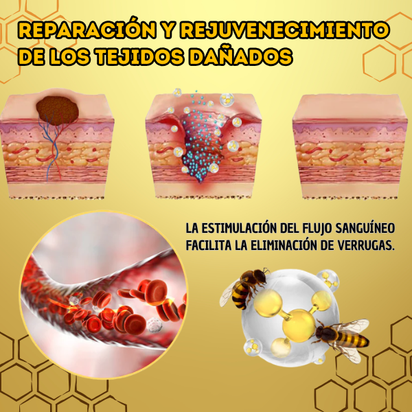 BeePure™ - Tratamiento de 7 Días para la Eliminacion de Verrugas 🐝