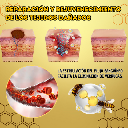 BeePure™ - Tratamiento de 7 Días para la Eliminacion de Verrugas 🐝