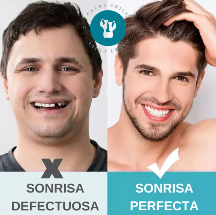 SonríeYa™ Dientes Postizos Temporales