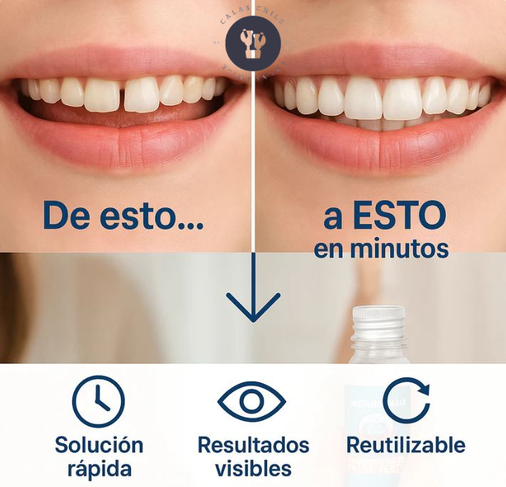 SonríeYa™ Dientes Postizos Temporales