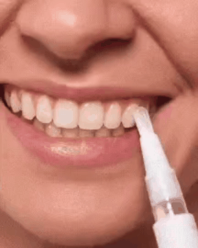 Blanqueador Dental-Dazzling White Original.